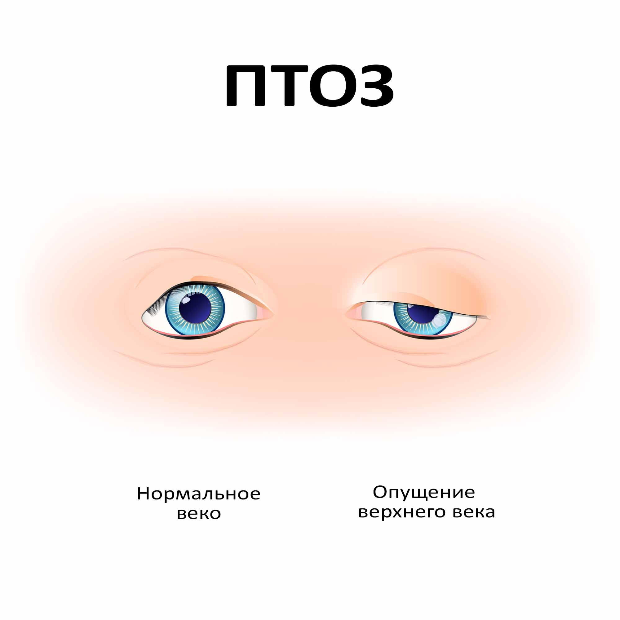 Виды операции