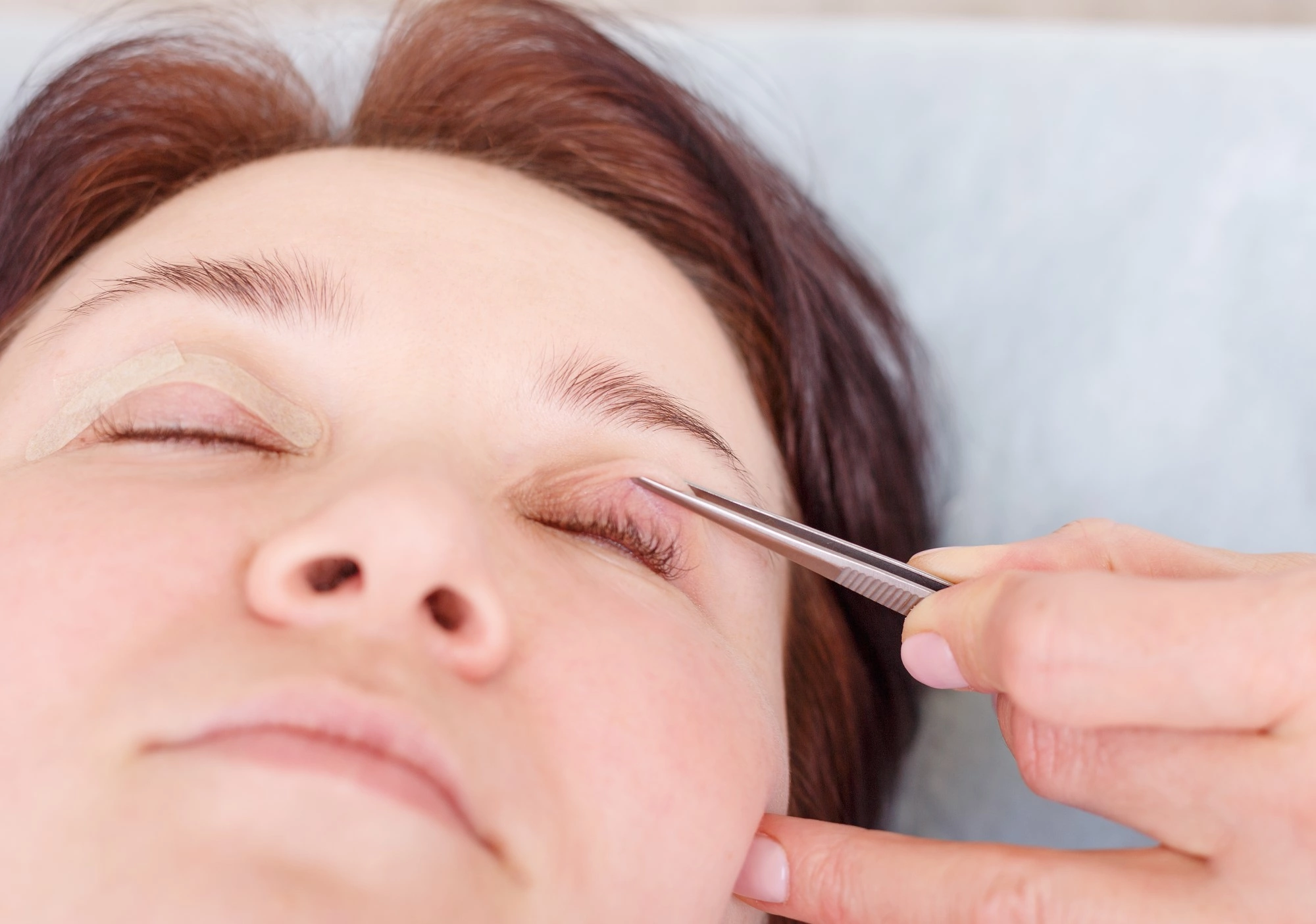 Eyelid