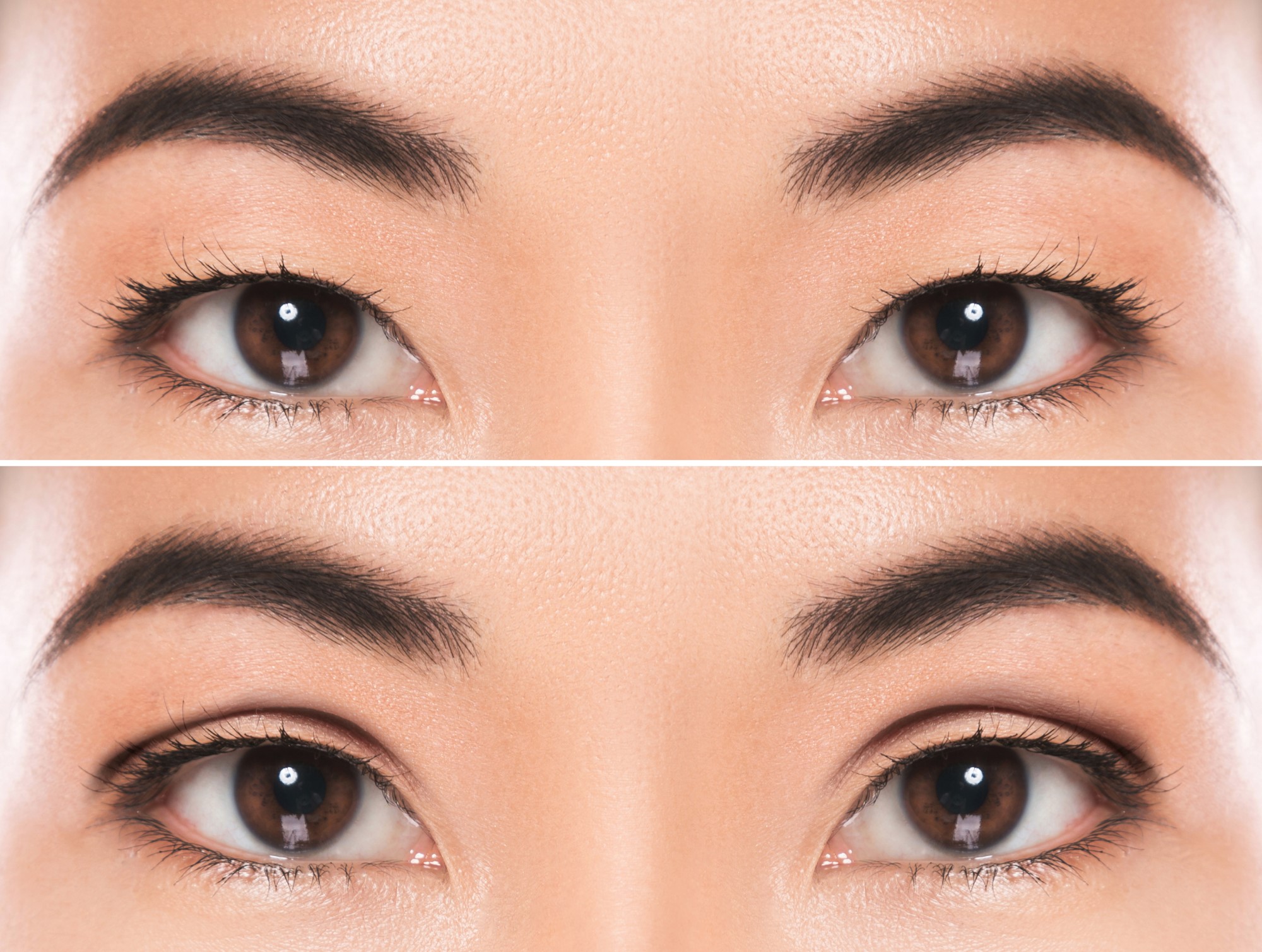Блефаропластика азиатских глаз
