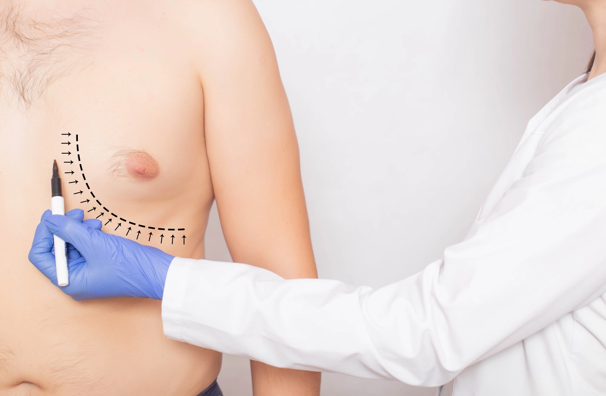 уплотнение в груди у женщин причины фото 45