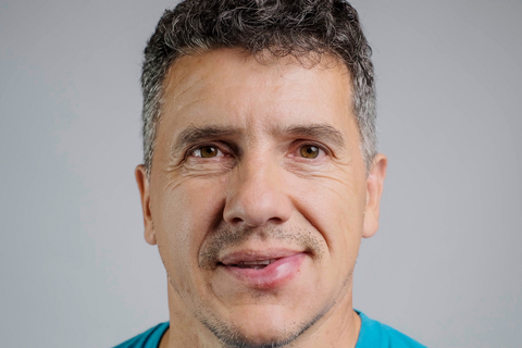 Асимметрия губ Асимметрия губ