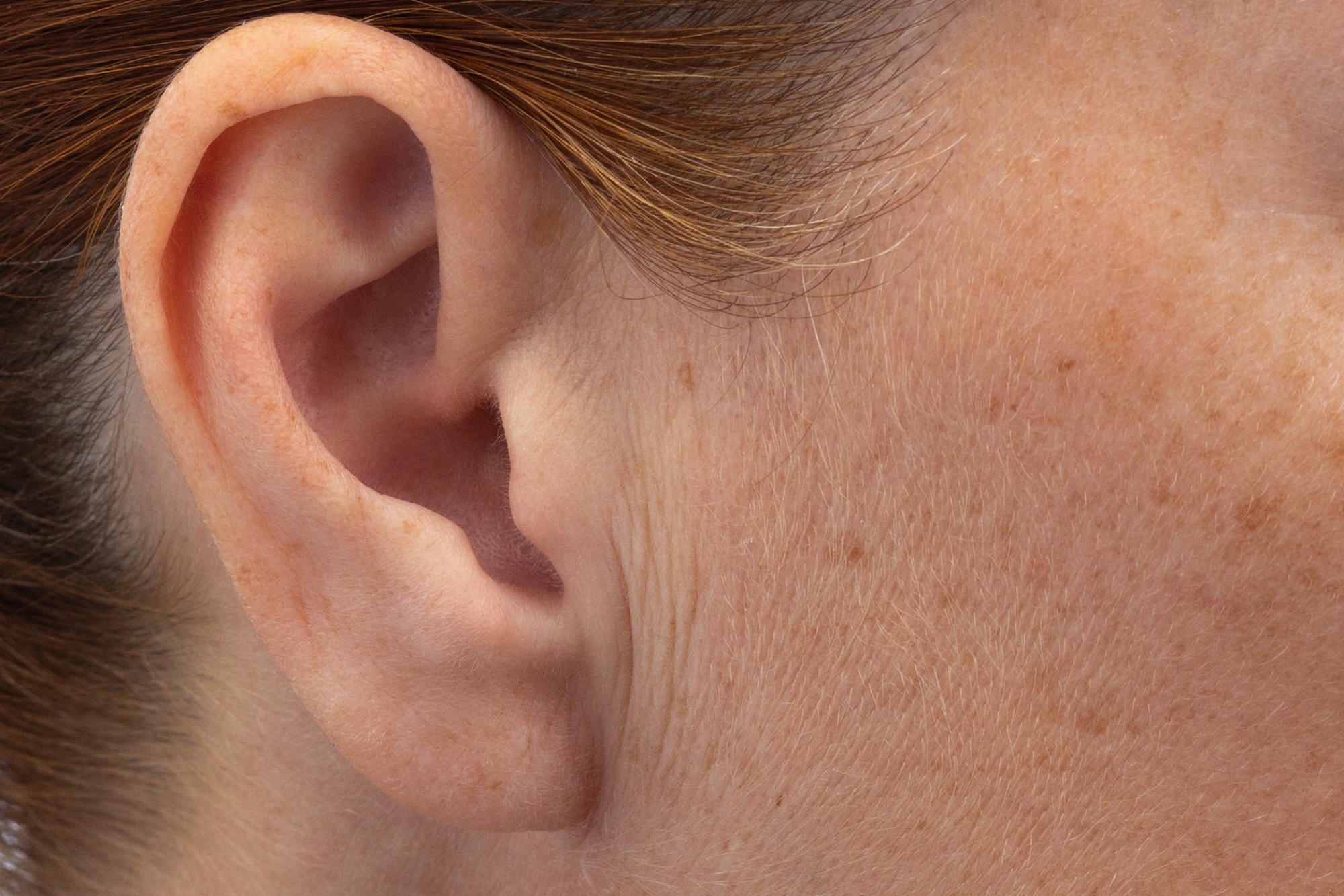 морщины возле ушей морщины возле ушей