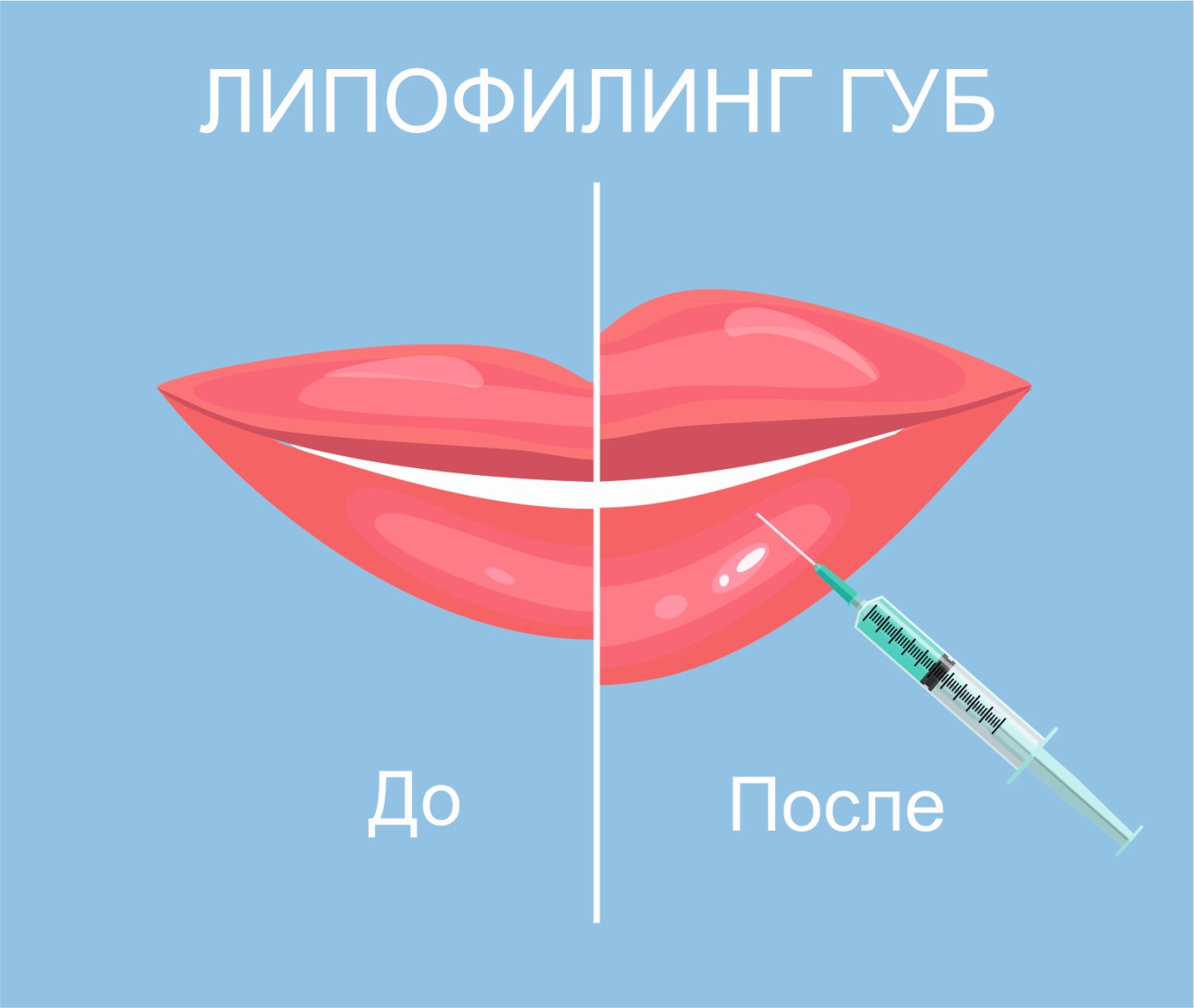 Липофилинг губ