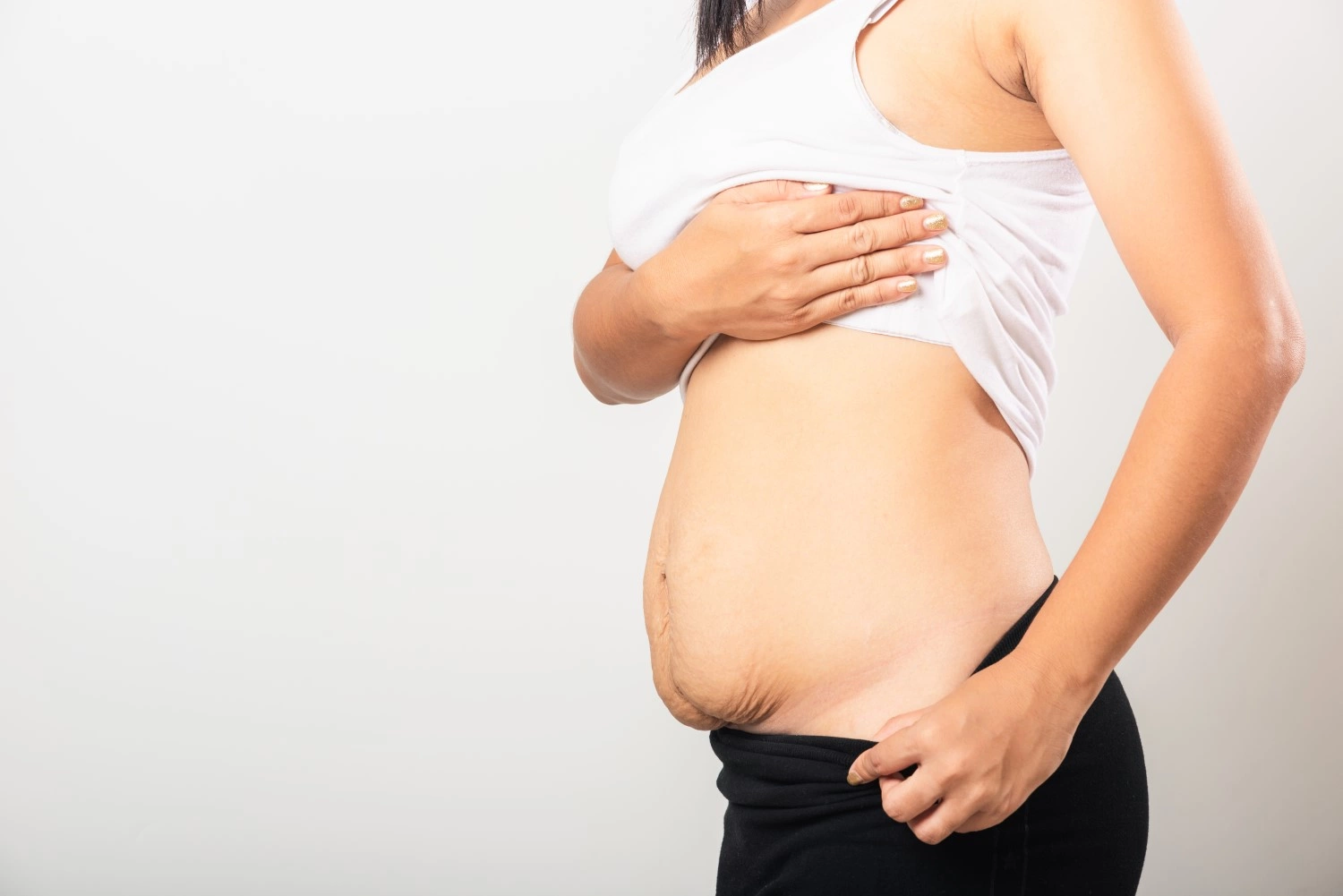 Почему живот остается после родов: причины и методы коррекции