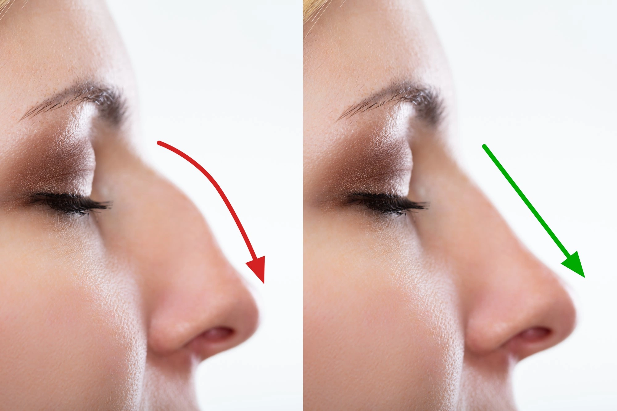 Как визуально сделать нос меньше без операции дома?