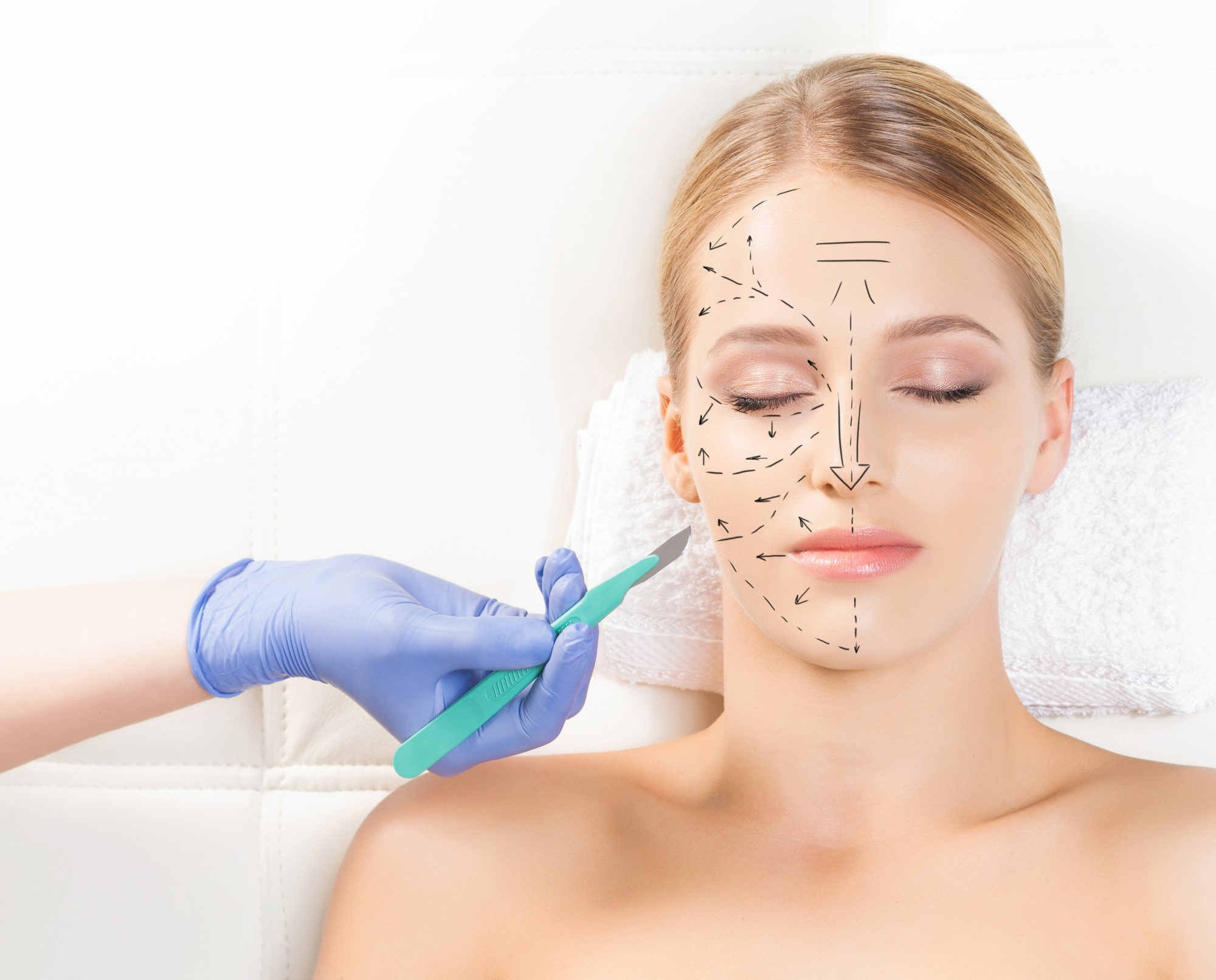 Подготовка к пластической операции на лице