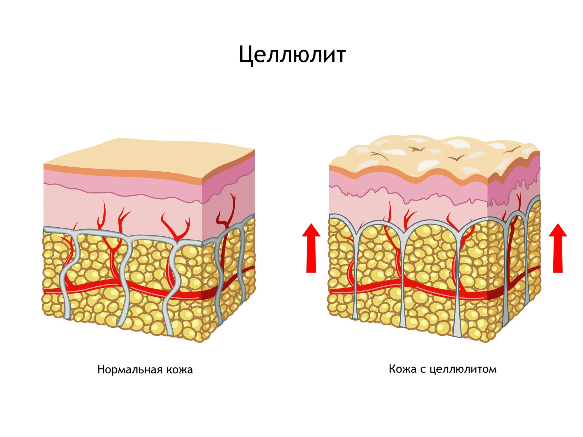 Основные зон